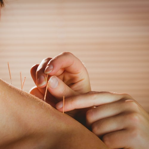acupuncture-Park-Physiotherapy-and-Foot-Clinic-Oshawa-ON