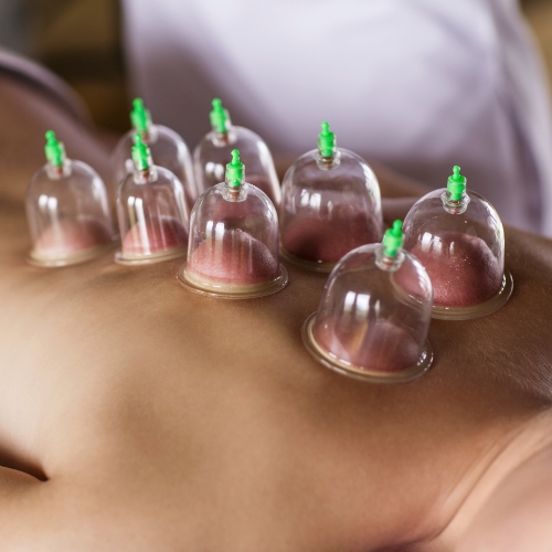 cupping-Park-Physiotherapy-and-Foot-Clinic-Oshawa-ON