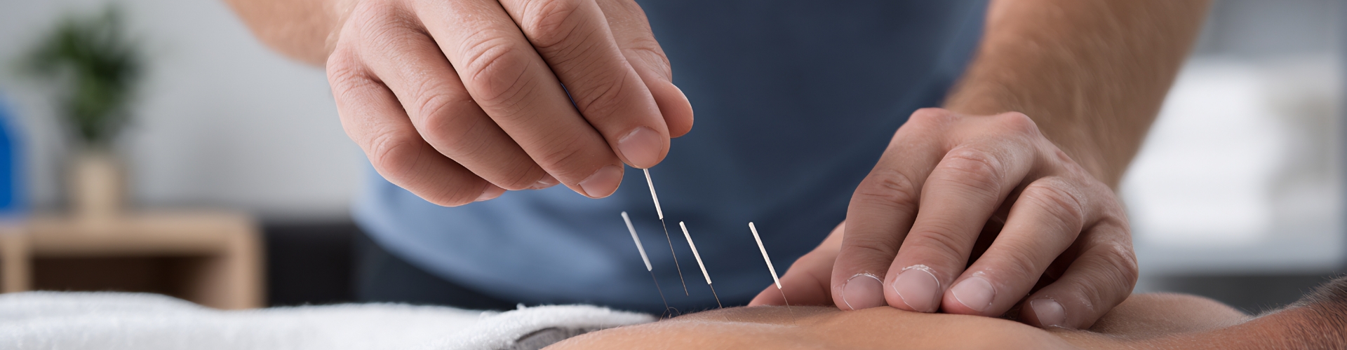 Dry Needling